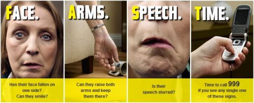 Know the signs of stroke and what to do